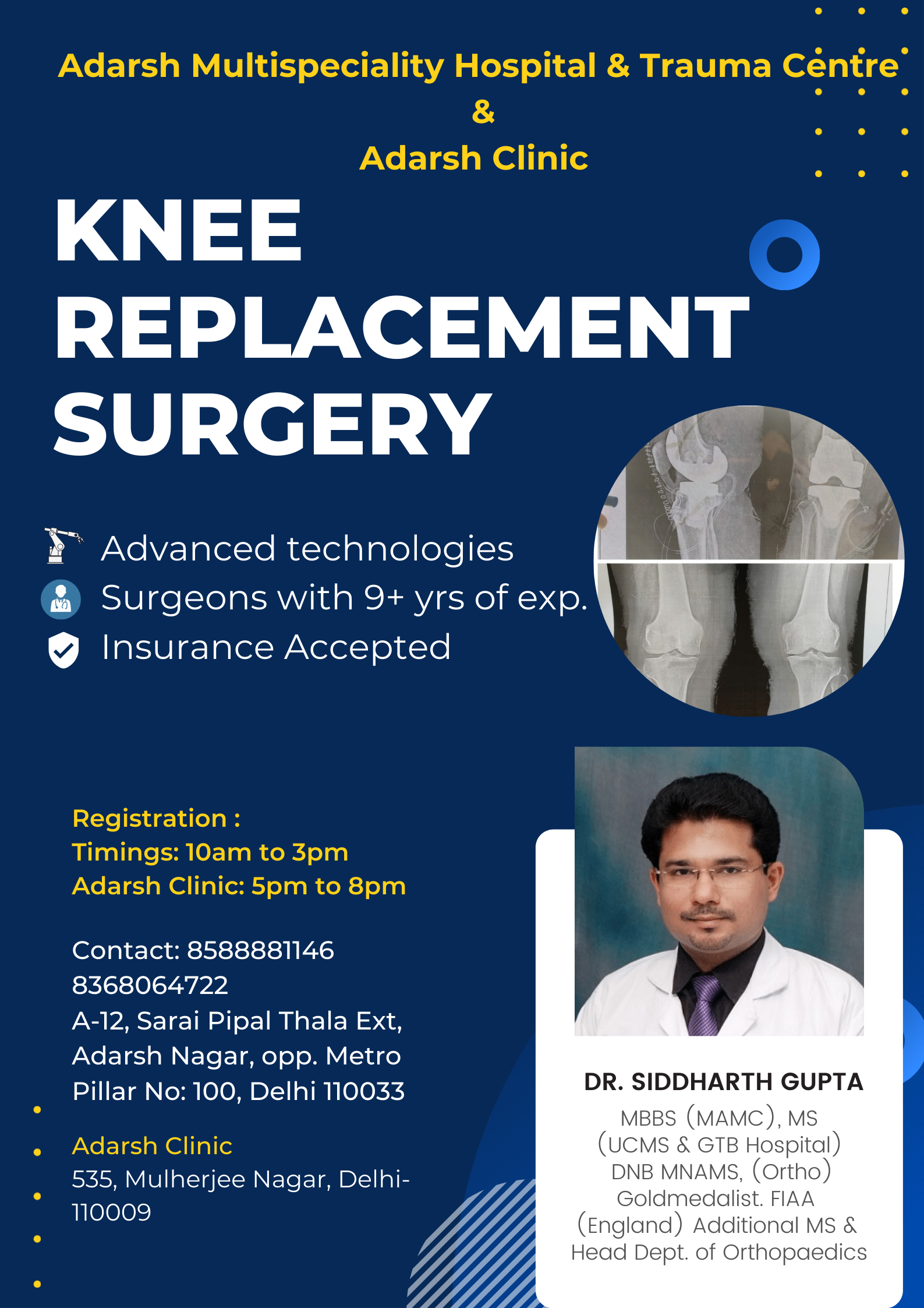 Knee Replacement